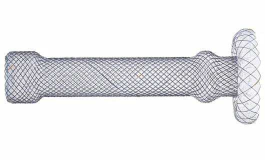 CITEC™ Cardia Stent, Cardia Umbrella Stent, Esophagus Stent, Esophageal Stent, Esophageal Stents, Esophagus Stents, Oesophageal stent, Esophageal Stenting, Endoluminal Stent, Gastroesophageal Stents, Esophageal or gastric anastomotic fistula