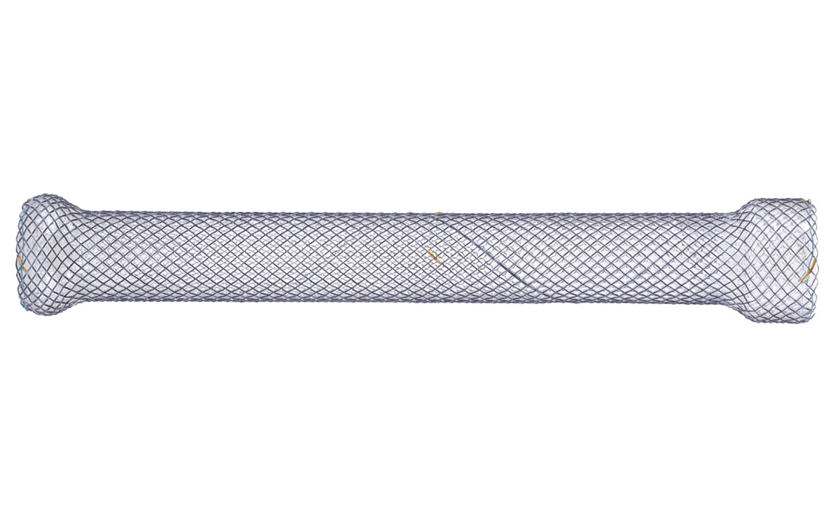 CITEC™ Bariatric Surgery Stent