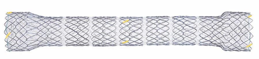 CITEC™ Segmented Esophageal Stent, Esophagus Stent, Esophageal Stent, Esophageal Stents, Esophagus Stents, Oesophageal stent, Esophageal Stenting, Endoluminal Stent, Gastroesophageal Stents