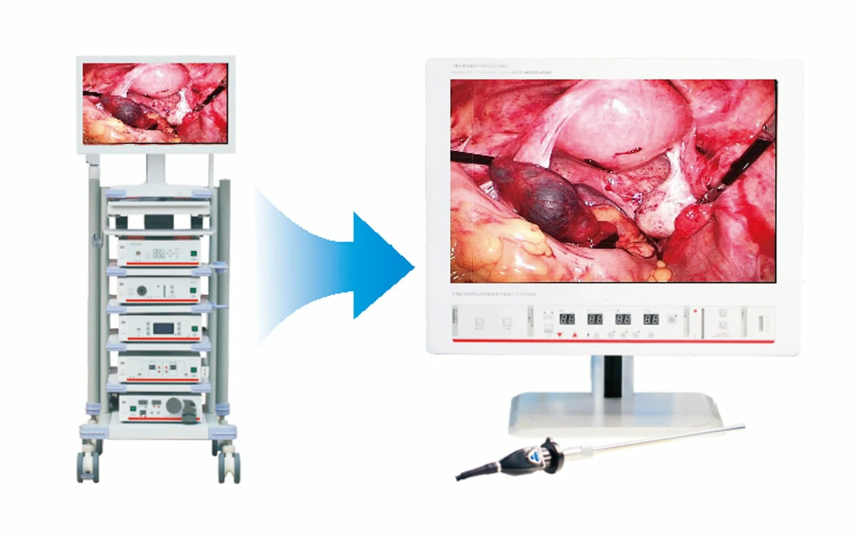 CITEC™ 4K Endoscopy System