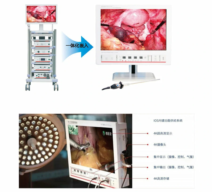 CITEC™ 4K Endoscopy System, Integrated Endoscopy Camera System, Endoscopy System, Surgical Endoscope System, Co2 Insufflator, 4K camera, LED coldlight source